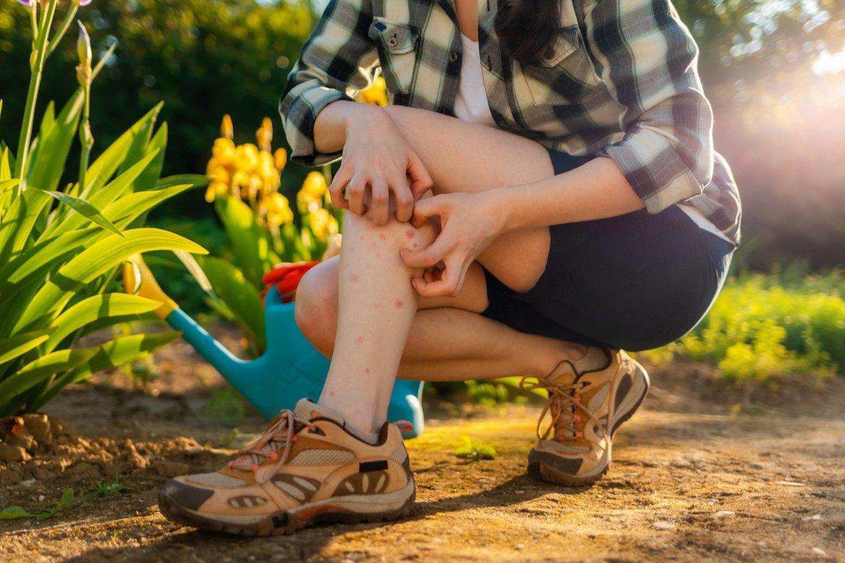 ¿Por qué tus mosquitos cortan más que otros?No es solo tu sangre: esto es realmente efectivo (y puedes evitarla)