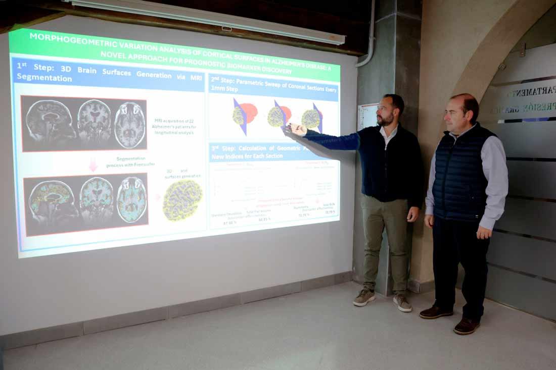 Identifican un biomarcador para detectar el Alzheimer