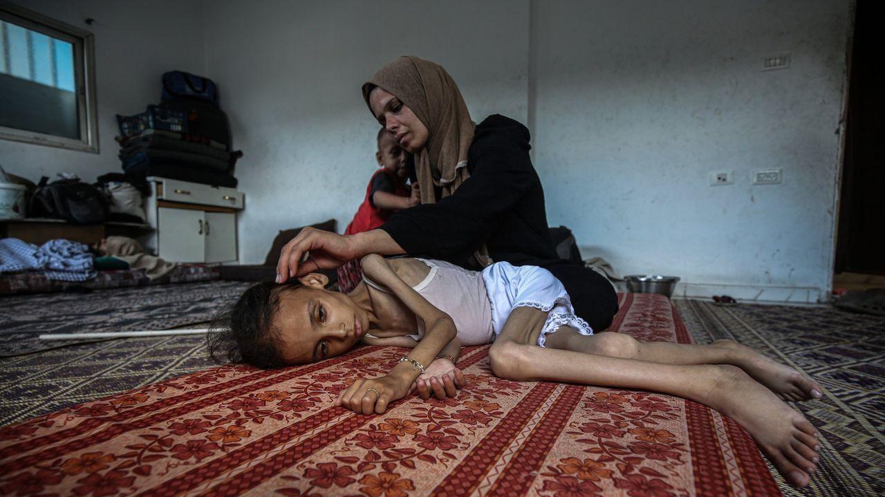 Casi cien menores murieron de hambre en Gaza desde el comienzo de la guerra.